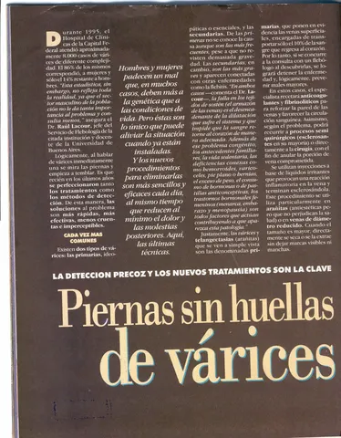 revista maxima argentina las varices y las piernas (3)